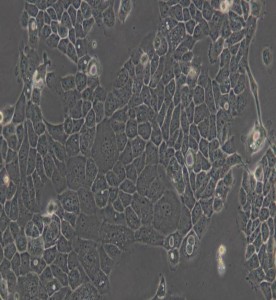 A-431人表皮癌細(xì)胞主圖