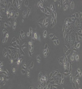 ACC-2人涎腺腺樣囊性癌細(xì)胞主圖