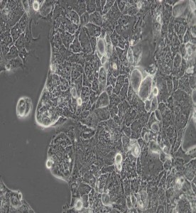 Caco-2人結(jié)直腸腺癌細(xì)胞主圖