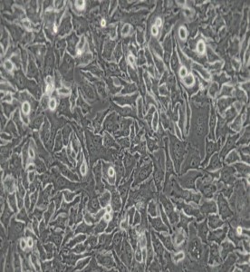 Hela-299人宮頸癌細(xì)胞主圖