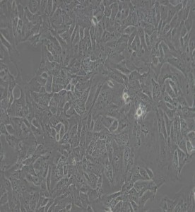 DLD-1人結(jié)直腸腺癌上皮細胞主圖