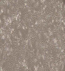 ES-2人卵巢透明細(xì)胞癌細(xì)胞主圖