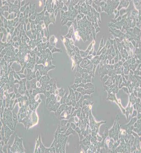 HCT-116人結(jié)腸癌細(xì)胞主圖