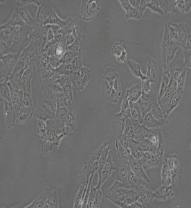 HT1080人纖維肉瘤細(xì)胞主圖