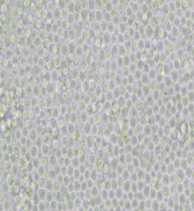 P388D1小鼠淋巴樣瘤細(xì)胞主圖