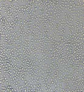 P815小鼠肥大細胞瘤細胞主圖