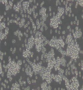 YAC-1小鼠淋巴瘤細(xì)胞主圖