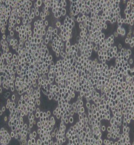 FO小鼠骨髓瘤細(xì)胞主圖