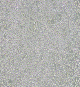 AE-1小鼠雜交瘤細(xì)胞(抗AChE)主圖