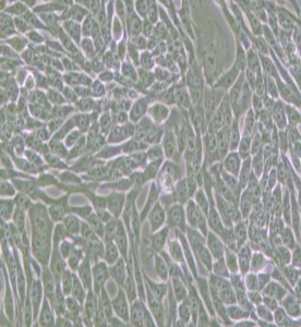 R-1610倉鼠肺細(xì)胞主圖