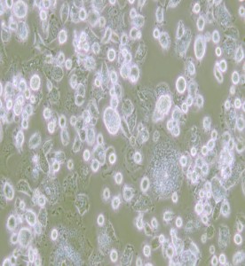 DH82狗腎惡性組織細(xì)胞增生癥細(xì)胞主圖