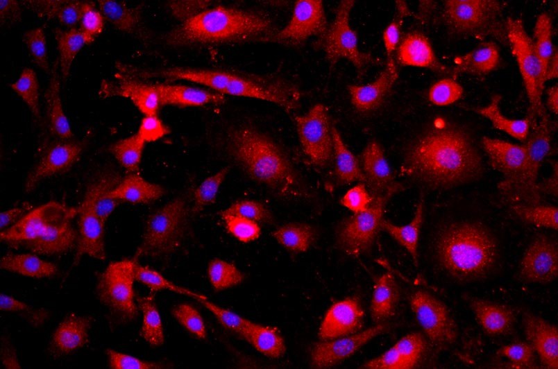 小鼠肺微血管內(nèi)皮細胞主圖