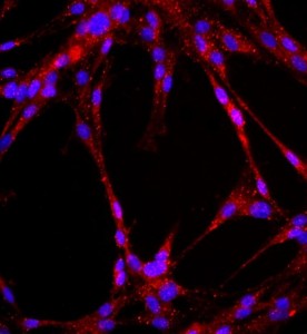 大鼠肺大動(dòng)脈內(nèi)皮細(xì)胞主圖