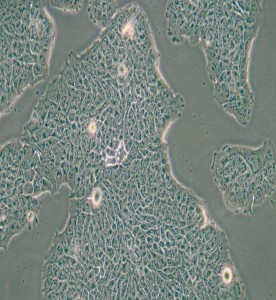 RT4人膀胱移行細(xì)胞乳頭瘤細(xì)胞主圖