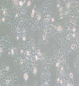 SK-N-AS人神經(jīng)母細(xì)胞瘤細(xì)胞主圖
