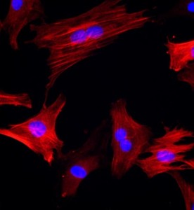 大鼠大隱靜脈平滑肌細(xì)胞主圖