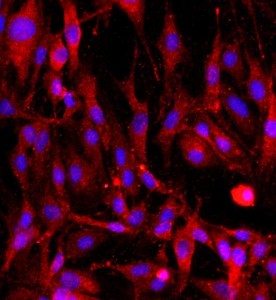 大鼠海綿體內(nèi)皮細(xì)胞主圖