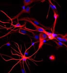 大鼠神經(jīng)星形膠質(zhì)細(xì)胞主圖