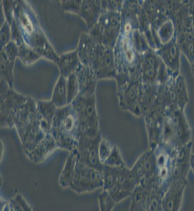 NCI-H1395人肺腺癌細(xì)胞主圖