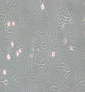 NCI-H1563人非小細(xì)胞肺癌細(xì)胞主圖