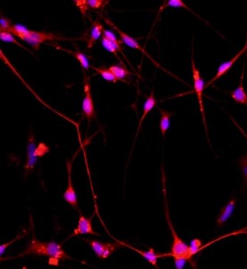 大鼠脊髓神經(jīng)元細胞主圖