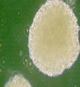 NK-92MI人惡性非霍奇金淋巴瘤患者的自然殺傷細(xì)胞主圖