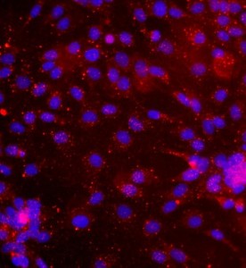 大鼠真皮微血管內(nèi)皮細(xì)胞主圖