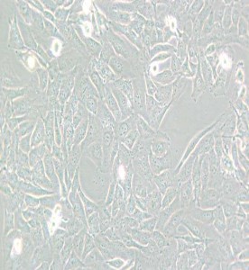 SW872人脂肪肉瘤細(xì)胞(L15) 主圖