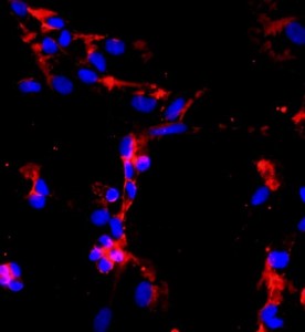 人肺微血管內(nèi)皮細(xì)胞主圖