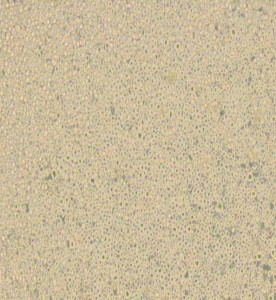 U266 [U266B1]人多發(fā)性骨髓瘤細胞主圖