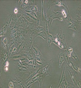WPMY-1人正常前列腺基質(zhì)永生化細(xì)胞主圖