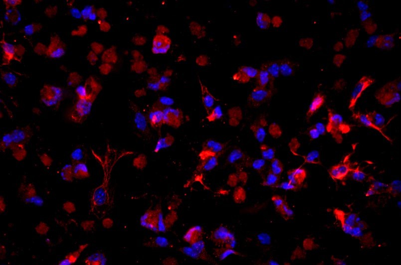 小鼠肝星狀細(xì)胞主圖