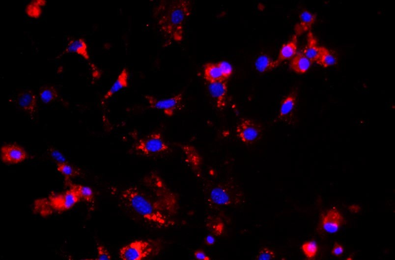 小鼠腎小球內(nèi)皮細(xì)胞主圖