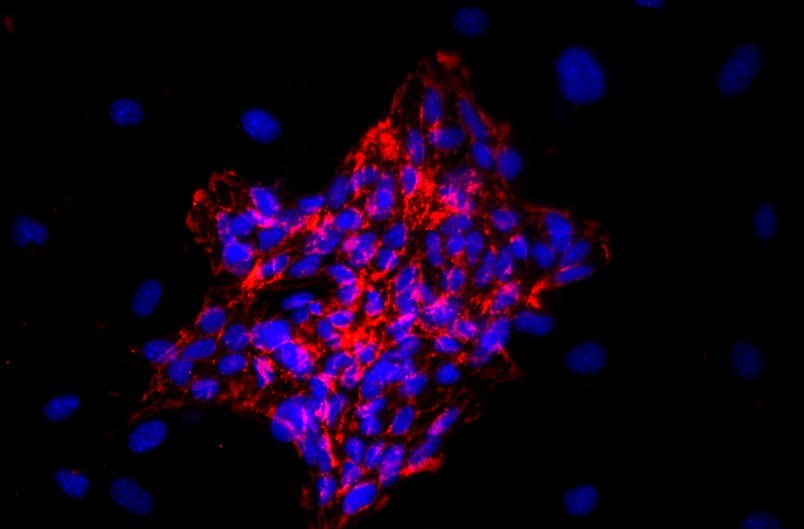 小鼠心臟微血管內(nèi)皮細(xì)胞主圖