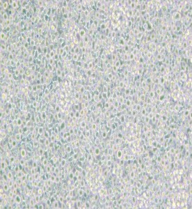 BeWo人絨毛膜腫瘤細(xì)胞主圖