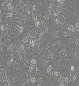 C918人眼脈絡(luò)黑色素瘤細胞主圖