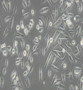 Calu-6人退行性癌細胞主圖