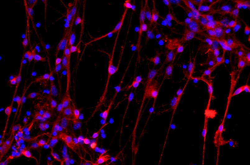 小鼠皮層神經(jīng)元細(xì)胞主圖