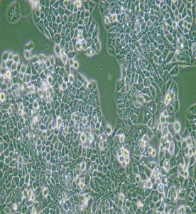 CX-1人結(jié)腸癌細(xì)胞主圖