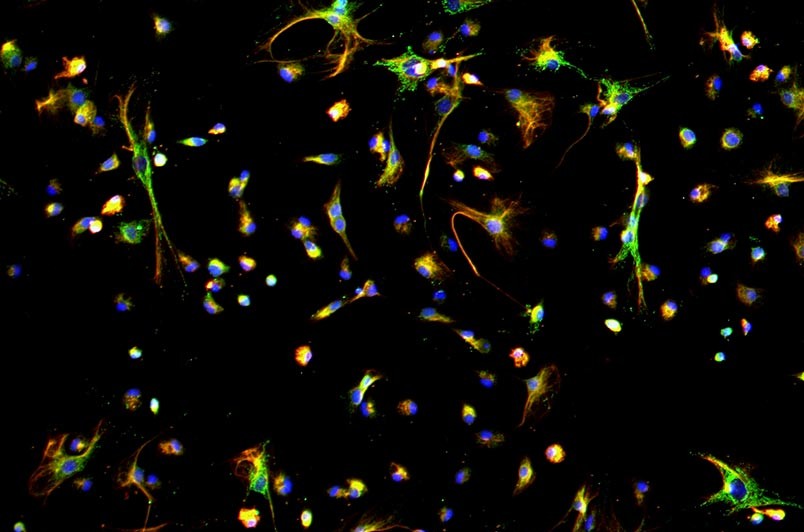 小鼠腹膜間皮細(xì)胞主圖