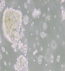 Farage人B淋巴瘤細(xì)胞主圖