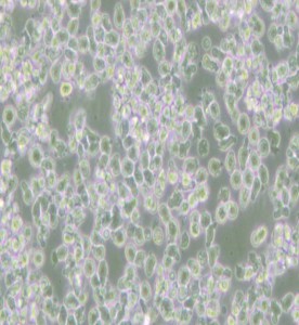 HMy2.CIR人B淋巴母細(xì)胞主圖