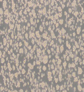 Jurkat, Clone E6-1人T淋巴細(xì)胞白血病細(xì)胞主圖