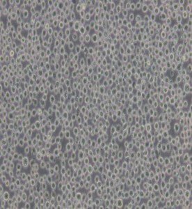 K-562人慢性髓原白血病細(xì)胞主圖