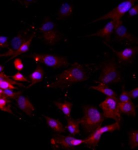 人椎間盤髓核細胞主圖