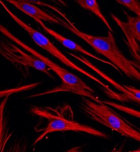 人牙周膜成纖維細(xì)胞主圖