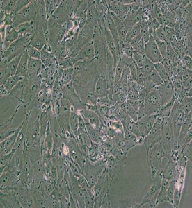 PED豬內(nèi)皮細胞主圖