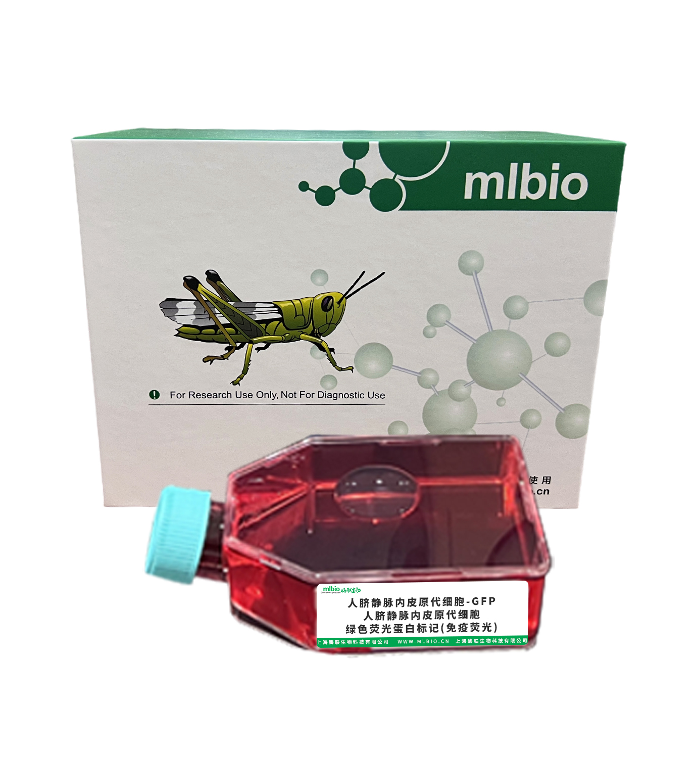 人臍靜脈內(nèi)皮原代細胞-GFP/人臍靜脈內(nèi)皮原代細胞-綠色熒光蛋白標(biāo)記(免疫熒光)主圖