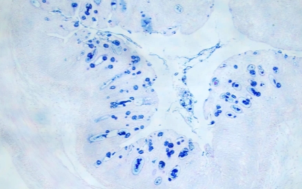 AB-PAS染色(中性粘液和糖原)主圖