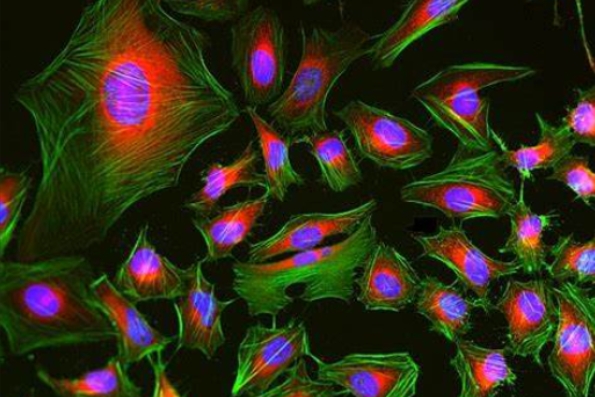免疫熒光雙標(biāo)三色染色主圖